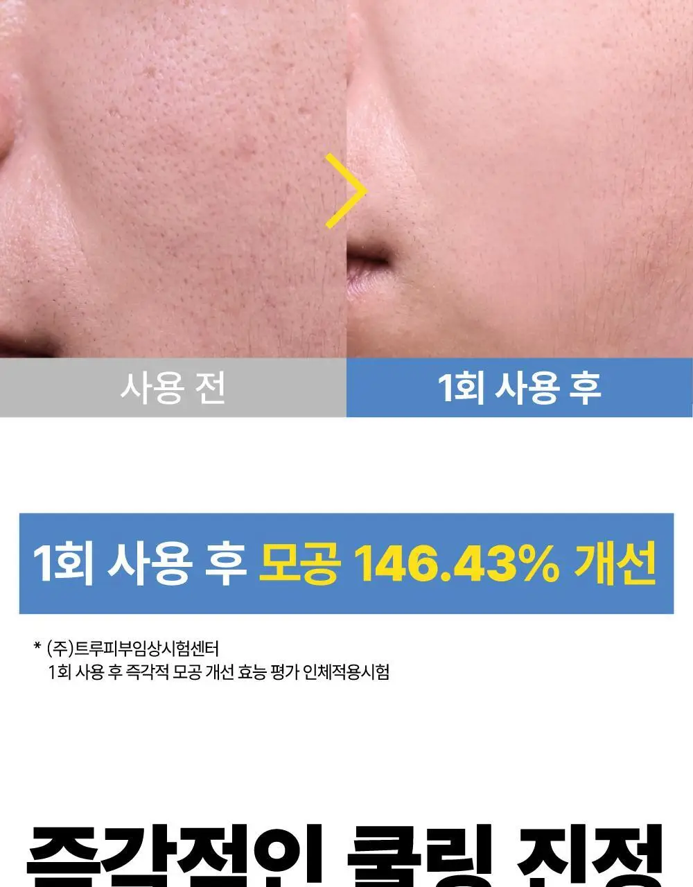 [500억유산균팩] 써니콘 마이크로바이옴 유산균 모델링팩 (7개입) 상세페이지 27